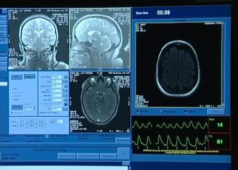 A monitor showing images of a mri.