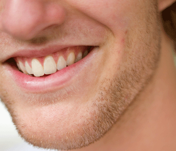 Close-up of the lower half of a person's face, showing a smile with teeth slightly visible and light facial hair on the chin and cheeks. The lips are slightly parted, and the focus is on the mouth area. The background is blurred.