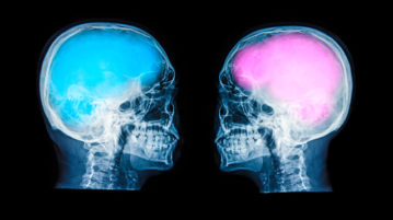 Does Gender Affect Mindfulness?