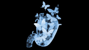 The Mindful Approach to Those Very Real Butterflies in Your Stomach x-ray butterflies in the stomach
